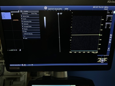 Color Doppler&nbsp;|&nbsp;GE&nbsp;|&nbsp;Logiq S8 XDclear