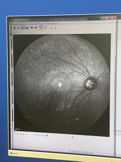 HRA2+ OCT+ WWE(55°), Retina and Glaucoma Module&nbsp;|&nbsp;Heidelberg Engineering GmbH&nbsp;|&nbsp;SPECTRALIS OCT2