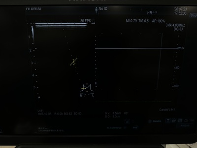 Ultrasound&nbsp;|&nbsp;FUJIFILM&nbsp;|&nbsp;ARIETTA 850SE