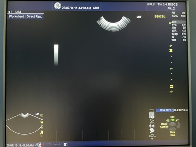 Color Doppler&nbsp;|&nbsp;GE&nbsp;|&nbsp;Logiq S7 Expert
