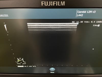 Ultrasound System&nbsp;|&nbsp;FUJIFILM&nbsp;|&nbsp;ARIETTA 50