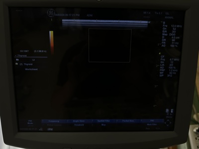 Color Doppler&nbsp;|&nbsp;GE&nbsp;|&nbsp;LOGIQ P5