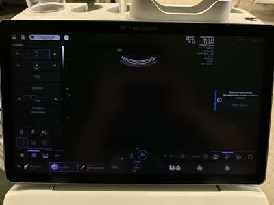 4D Ultrasound&nbsp;|&nbsp;GE&nbsp;|&nbsp;Voluson Swift BT23