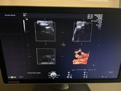4D Ultrasound&nbsp;|&nbsp;GE&nbsp;|&nbsp;Voluson E10 BT20