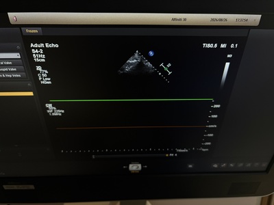Ultrasound&nbsp;|&nbsp;Philips&nbsp;|&nbsp;Affiniti 30