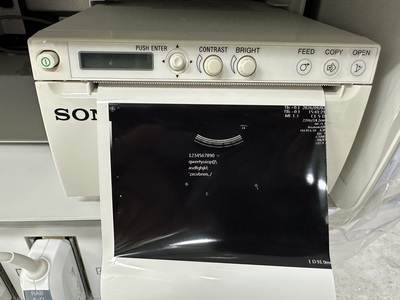 4D Ultrasound&nbsp;|&nbsp;GE&nbsp;|&nbsp;Voluson E8 BT17