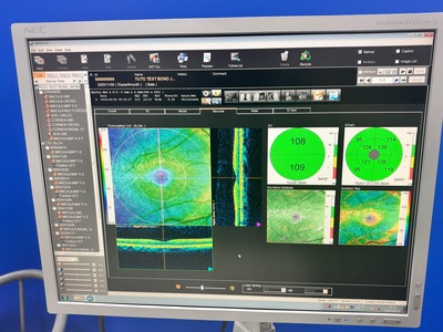 Fully Refurbished OCT with Angiography + Anterior Lens kit&nbsp;|&nbsp;NIDEK&nbsp;|&nbsp;RS-3000 Advance