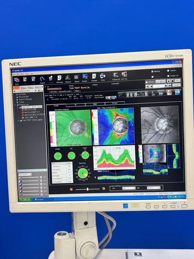 High-performance SD-OCT at the best price for private practitioners. — Nidek RS-3000 Lite&nbsp;|&nbsp;NIDEK&nbsp;|&nbsp;RS-3000 Lite