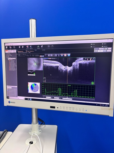 12-megapixel fundus photography × ultra-high-definition OCT&nbsp;|&nbsp;NIDEK&nbsp;|&nbsp;RS-330 Retina Scan Duo