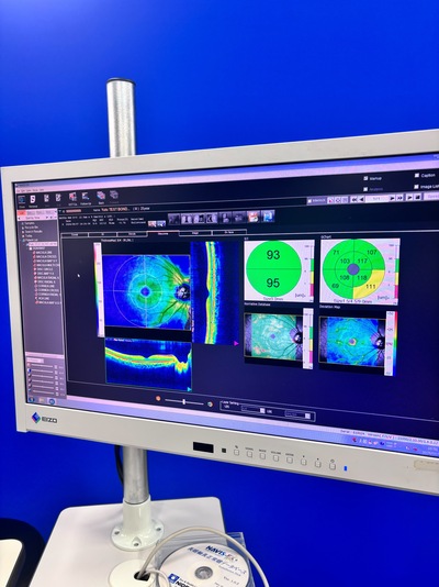 ANGIOGRAPHY Installed. No injections required. An unprecedented, high-definition 3D map of retinal blood flow drawn with light.&nbsp;|&nbsp;NIDEK&nbsp;|&nbsp;RS-3000 Advance