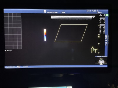 Color Doppler&nbsp;|&nbsp;GE&nbsp;|&nbsp;Logiq S8 XDclear
