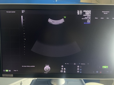 4D Ultrasound&nbsp;|&nbsp;GE&nbsp;|&nbsp;Voluson E10 BT19