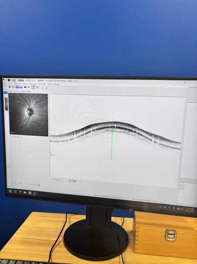 現行最高峰の医療資産-マルチモーダルイメージングプラットフォーム 「SPECTRALIS（スペクトラリス）with SHIFT Technology / 2023年製造モデル」&nbsp;|&nbsp;株式会社 JFC セールスプラン&nbsp;|&nbsp;OCT SHIFTの写真