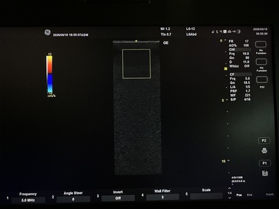 Ultrasound&nbsp;|&nbsp;GE&nbsp;|&nbsp;Versana Active