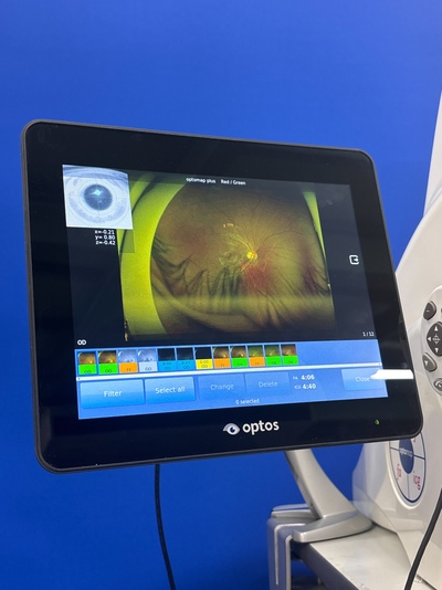 Color RG,af,fa,icg, 200° ultra-widefield retinal image&nbsp;|&nbsp;Optos, Inc. (Nikon)&nbsp;|&nbsp;California
