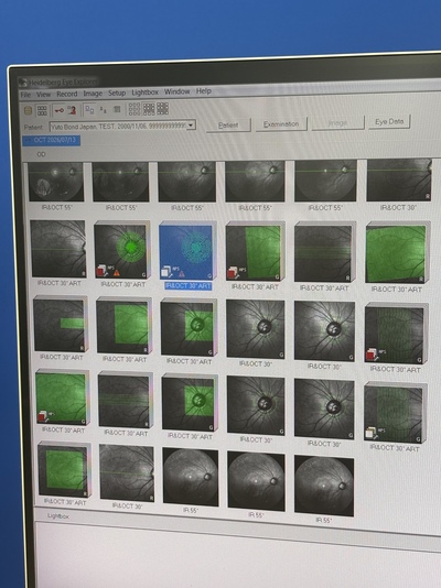 HRA2+ OCT+ WWE(55°), Retina and Glaucoma Module&nbsp;|&nbsp;Heidelberg Engineering GmbH&nbsp;|&nbsp;SPECTRALIS OCT2
