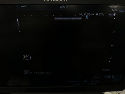 Ultrasound&nbsp;|&nbsp;FUJIFILM&nbsp;|&nbsp;ARIETTA 850SE