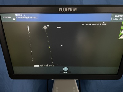 Ultrasound System&nbsp;|&nbsp;FUJIFILM&nbsp;|&nbsp;ARIETTA 50