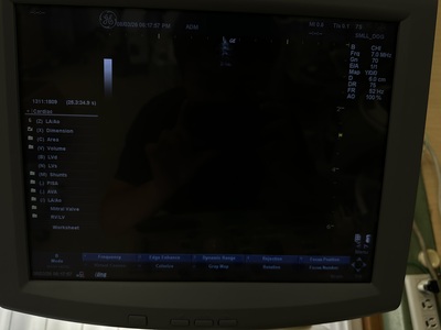 Color Doppler&nbsp;|&nbsp;GE&nbsp;|&nbsp;LOGIQ P5