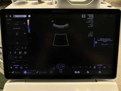 4D Ultrasound&nbsp;|&nbsp;GE&nbsp;|&nbsp;Voluson Swift BT23
