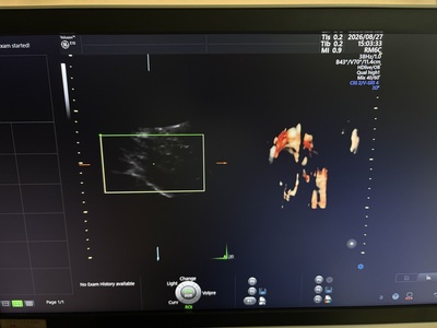 4D Ultrasound&nbsp;|&nbsp;GE&nbsp;|&nbsp;Voluson E10 BT20
