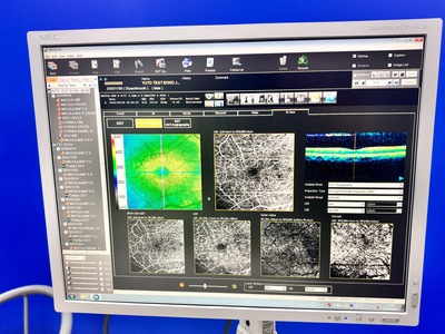 Fully Refurbished OCT with Angiography + Anterior Lens kit&nbsp;|&nbsp;NIDEK&nbsp;|&nbsp;RS-3000 Advance