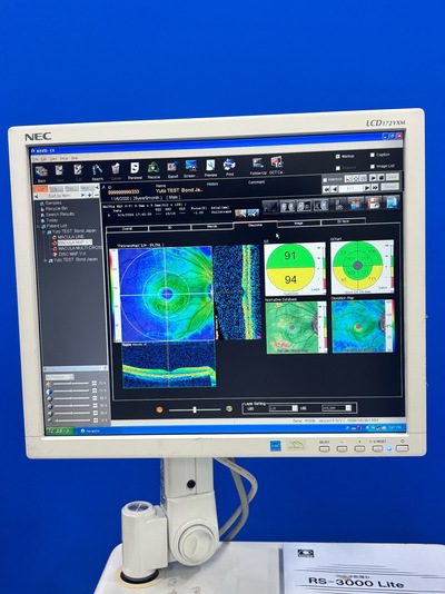High-performance SD-OCT at the best price for private practitioners. — Nidek RS-3000 Lite&nbsp;|&nbsp;NIDEK&nbsp;|&nbsp;RS-3000 Lite