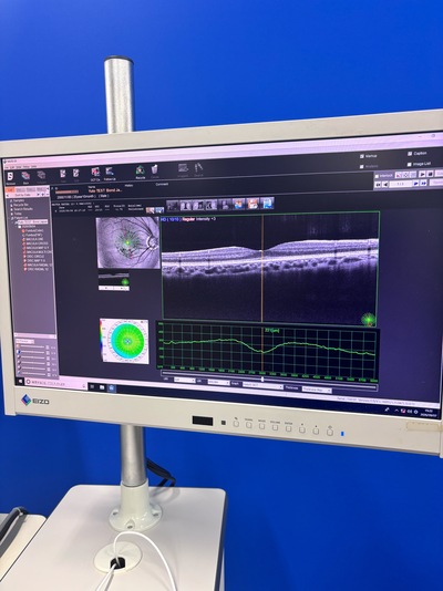 12-megapixel fundus photography × ultra-high-definition OCT&nbsp;|&nbsp;NIDEK&nbsp;|&nbsp;RS-330 Retina Scan Duo