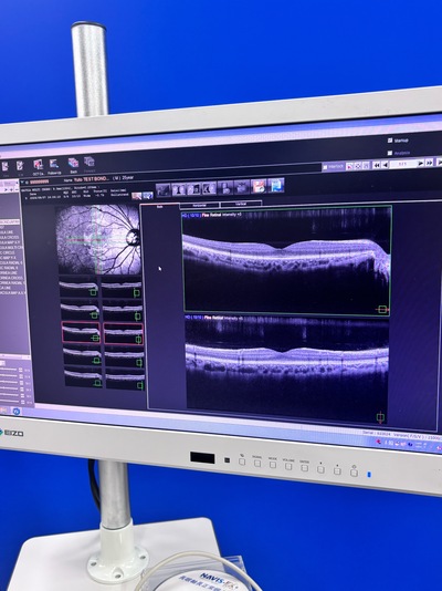 ANGIOGRAPHY Installed. No injections required. An unprecedented, high-definition 3D map of retinal blood flow drawn with light.&nbsp;|&nbsp;NIDEK&nbsp;|&nbsp;RS-3000 Advance