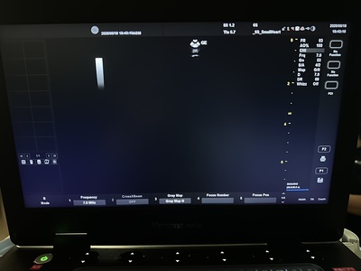 Ultrasound&nbsp;|&nbsp;GE&nbsp;|&nbsp;Versana Active