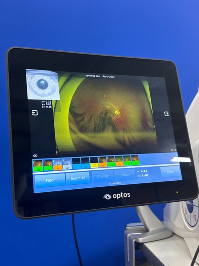 Color RG,af,fa,icg, 200° ultra-widefield retinal image&nbsp;|&nbsp;Optos, Inc. (Nikon)&nbsp;|&nbsp;California