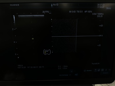 Ultrasound&nbsp;|&nbsp;FUJIFILM&nbsp;|&nbsp;ARIETTA 850SE