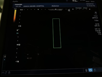 Color Doppler&nbsp;|&nbsp;CANON&nbsp;|&nbsp;Aplio 400