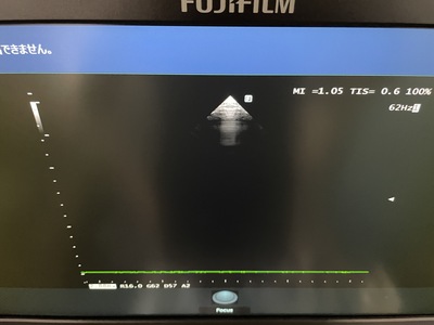 Ultrasound System&nbsp;|&nbsp;FUJIFILM&nbsp;|&nbsp;ARIETTA 50