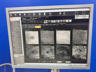 Fully Refurbished OCT with Angiography + Anterior Lens kit&nbsp;|&nbsp;NIDEK&nbsp;|&nbsp;RS-3000 Advance