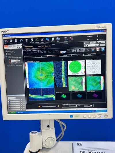 High-performance SD-OCT at the best price for private practitioners. — Nidek RS-3000 Lite&nbsp;|&nbsp;NIDEK&nbsp;|&nbsp;RS-3000 Lite