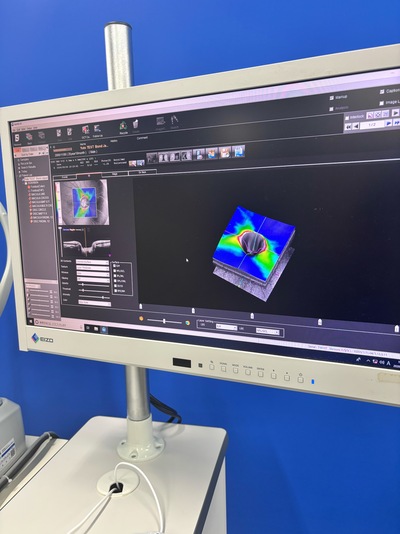 12-megapixel fundus photography × ultra-high-definition OCT&nbsp;|&nbsp;NIDEK&nbsp;|&nbsp;RS-330 Retina Scan Duo