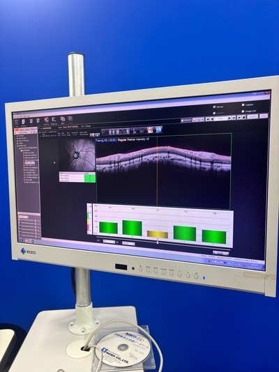 ANGIOGRAPHY Installed. No injections required. An unprecedented, high-definition 3D map of retinal blood flow drawn with light.&nbsp;|&nbsp;NIDEK&nbsp;|&nbsp;RS-3000 Advance
