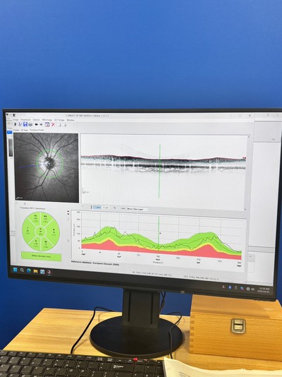 現行最高峰の医療資産-マルチモーダルイメージングプラットフォーム 「SPECTRALIS（スペクトラリス）with SHIFT Technology / 2023年製造モデル」&nbsp;|&nbsp;株式会社 JFC セールスプラン&nbsp;|&nbsp;OCT SHIFTの写真