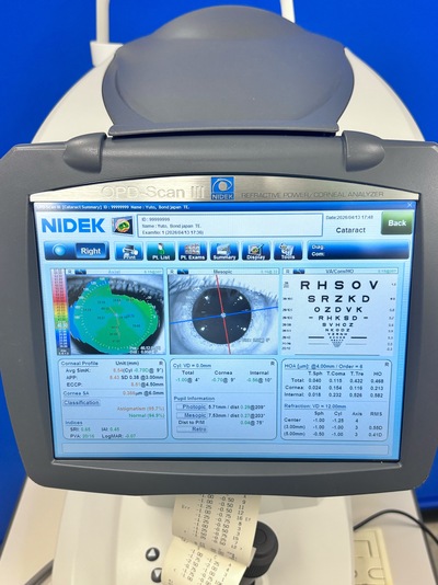 Wavefront Aberrometer&nbsp;|&nbsp;NIDEK&nbsp;|&nbsp;OPD-Scan III