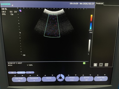 Ulltrasound&nbsp;|&nbsp;SIEMENS&nbsp;|&nbsp;Sonovista X500