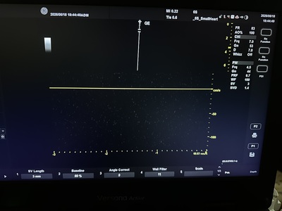 Ultrasound&nbsp;|&nbsp;GE&nbsp;|&nbsp;Versana Active