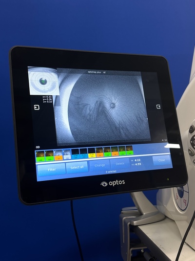 Color RG,af,fa,icg, 200° ultra-widefield retinal image&nbsp;|&nbsp;Optos, Inc. (Nikon)&nbsp;|&nbsp;California