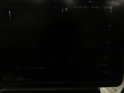 Ultrasound&nbsp;|&nbsp;FUJIFILM&nbsp;|&nbsp;ARIETTA 850SE