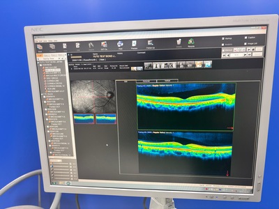 Fully Refurbished OCT with Angiography + Anterior Lens kit&nbsp;|&nbsp;NIDEK&nbsp;|&nbsp;RS-3000 Advance