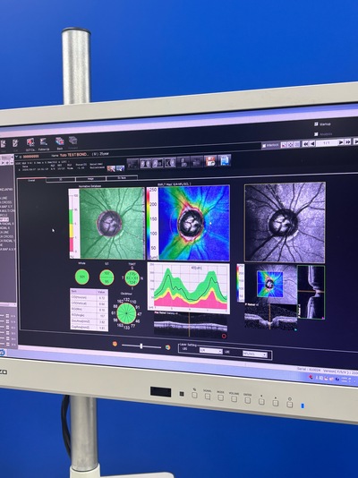 ANGIOGRAPHY Installed. No injections required. An unprecedented, high-definition 3D map of retinal blood flow drawn with light.&nbsp;|&nbsp;NIDEK&nbsp;|&nbsp;RS-3000 Advance
