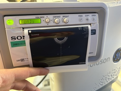 4D Ultrasound&nbsp;|&nbsp;GE&nbsp;|&nbsp;Voluson Swift BT23