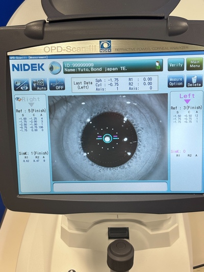 Wavefront Aberrometer&nbsp;|&nbsp;NIDEK&nbsp;|&nbsp;OPD-Scan III