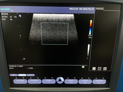 Ulltrasound&nbsp;|&nbsp;SIEMENS&nbsp;|&nbsp;Sonovista X500