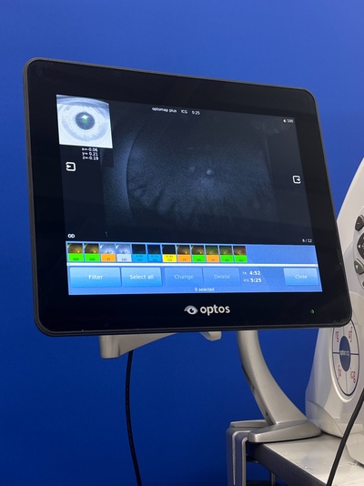 Color RG,af,fa,icg, 200° ultra-widefield retinal image&nbsp;|&nbsp;Optos, Inc. (Nikon)&nbsp;|&nbsp;California
